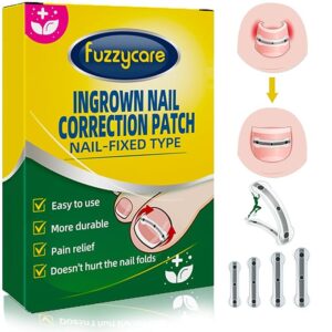 Ingrown Toenail Treatment