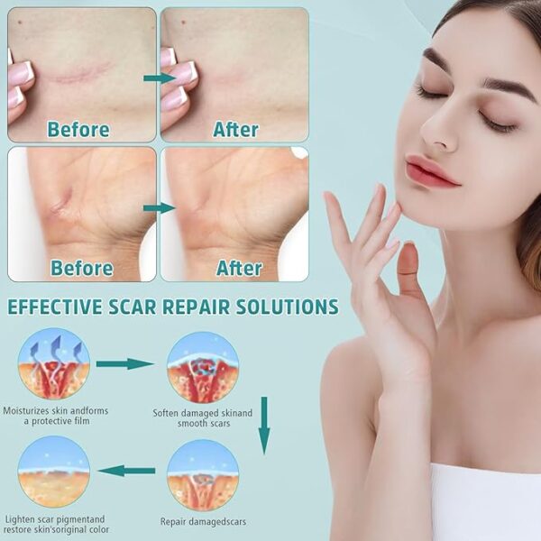Advanced Scar Cream - Image 4