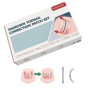 Titanium Alloy Ingrown Toenail