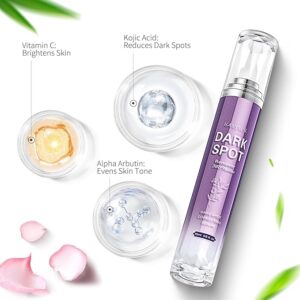 HANYWIL Dark Spot Remover for Face