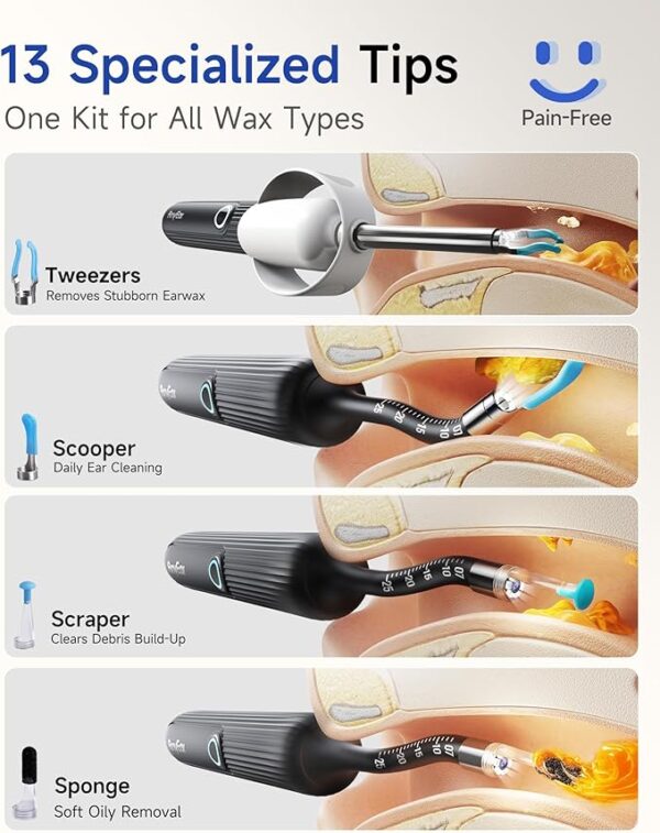 Anyear Flexible Ear Wax Removal - Image 2