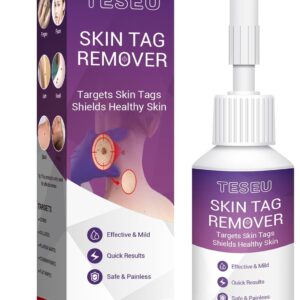 TESEU Wart Remover