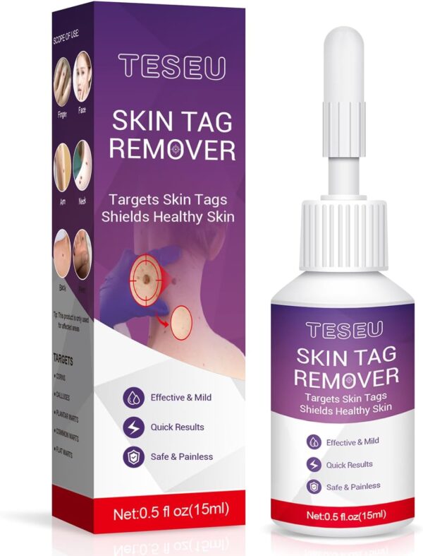 TESEU Wart Remover