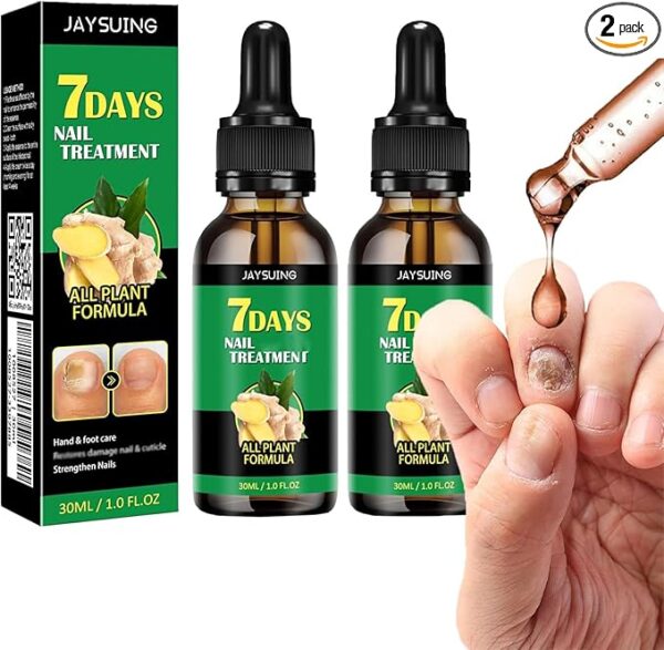 UOSFSRR Nail Treatment