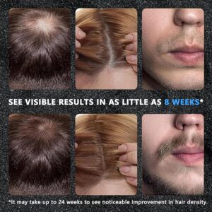 YNGLLC 5% Minoxidil Hair Growth